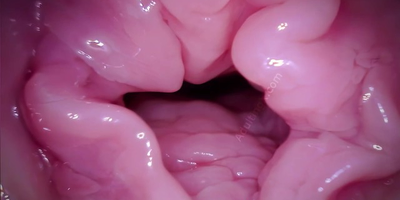 close-ups